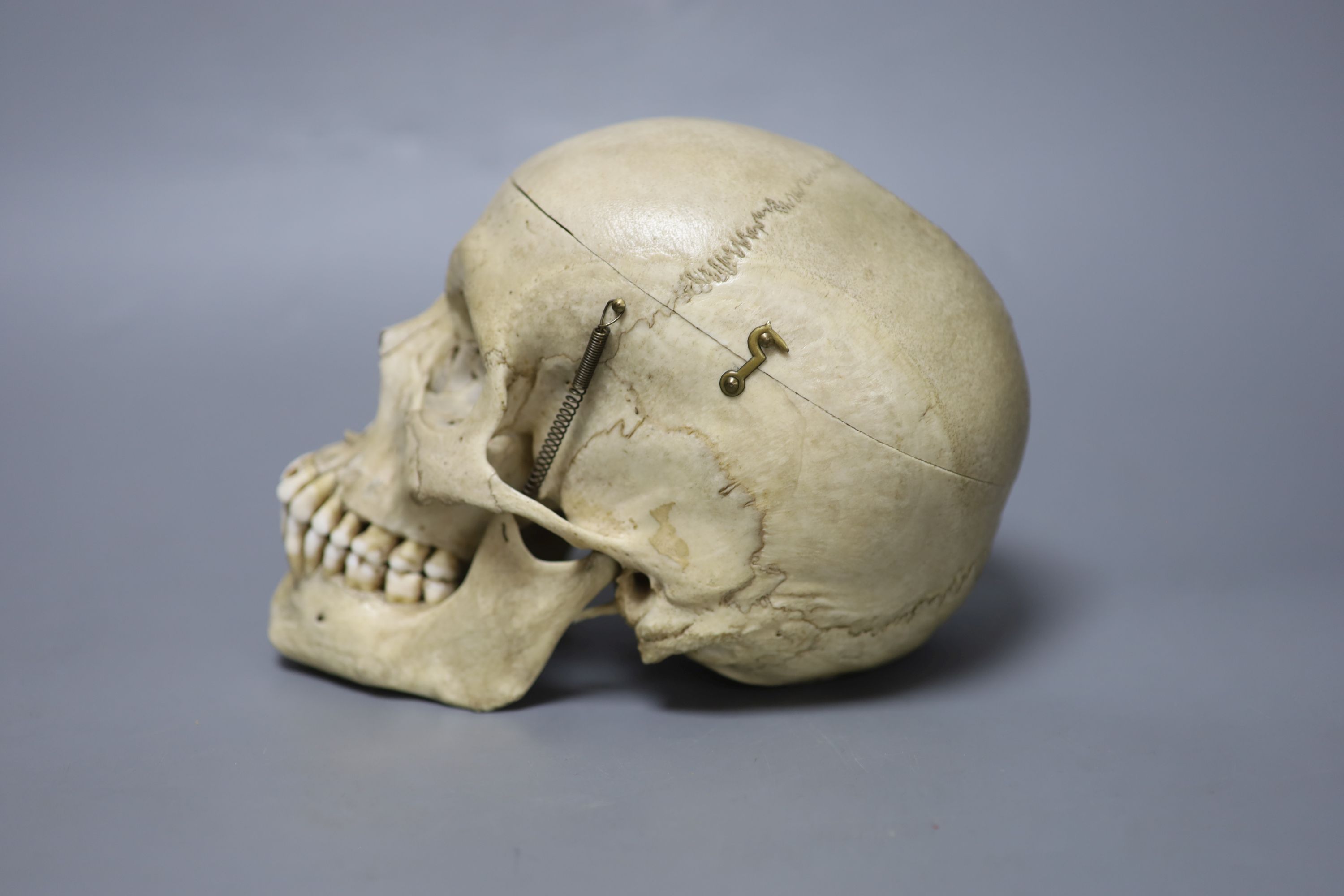 A human skull, with removable cranium and sprung jaw, height 16cm